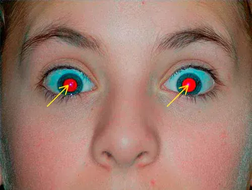 Retirando Olhos Vermelhos no Photoshop